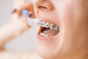 Prawidłowe czyszczenie zębów